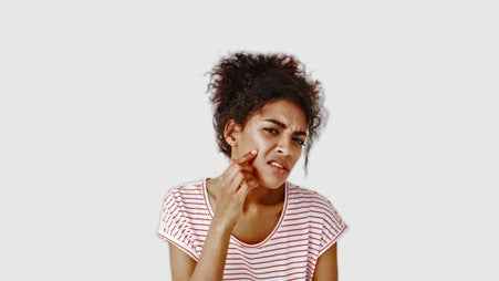 DEALING WITH ACNE