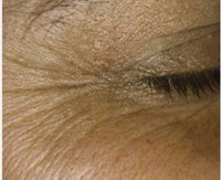 Before After Image 4