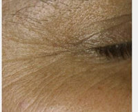 Before After Image 5