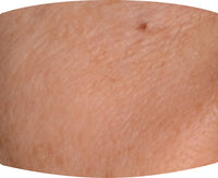 Before After Image 1