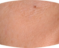 Before After Image 6