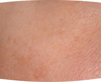 Before After Image 2