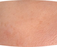 Before After Image 3